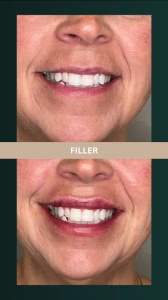 d1097c_2f8deb9a2e9741898e06a18641aa1d9e~mv2