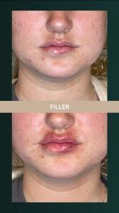 d1097c_bac6936e97ad42148068cdb856db0058~mv2