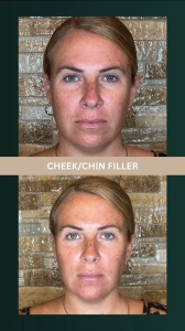 d1097c_e83891ebbf924820a64797554bbebdd3~mv2