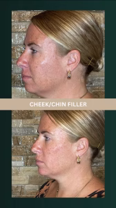 d1097c_ecc258e668844ac8887044d1962ffc15~mv2